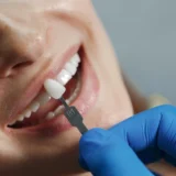dedrietand veneers