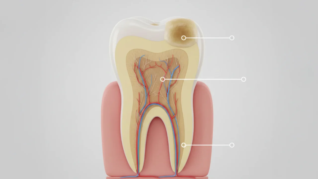 Waarom Ontstaat Tandenverkleuring en Hoe Verdwijnt Het?