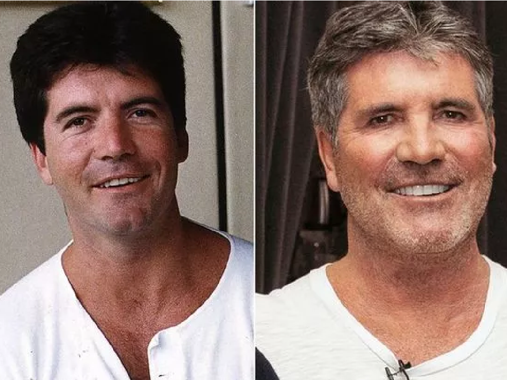 Welke beroemdheden hebben een tandheelkundige fineer?