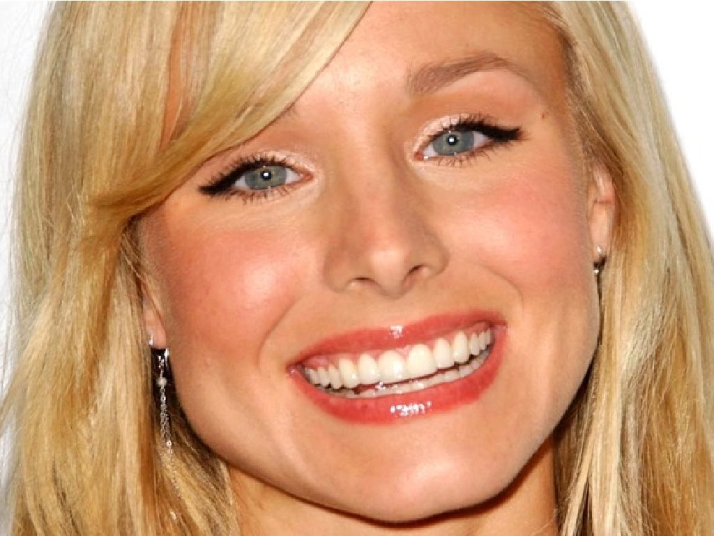 Welke beroemdheden hebben een tandheelkundige fineer?