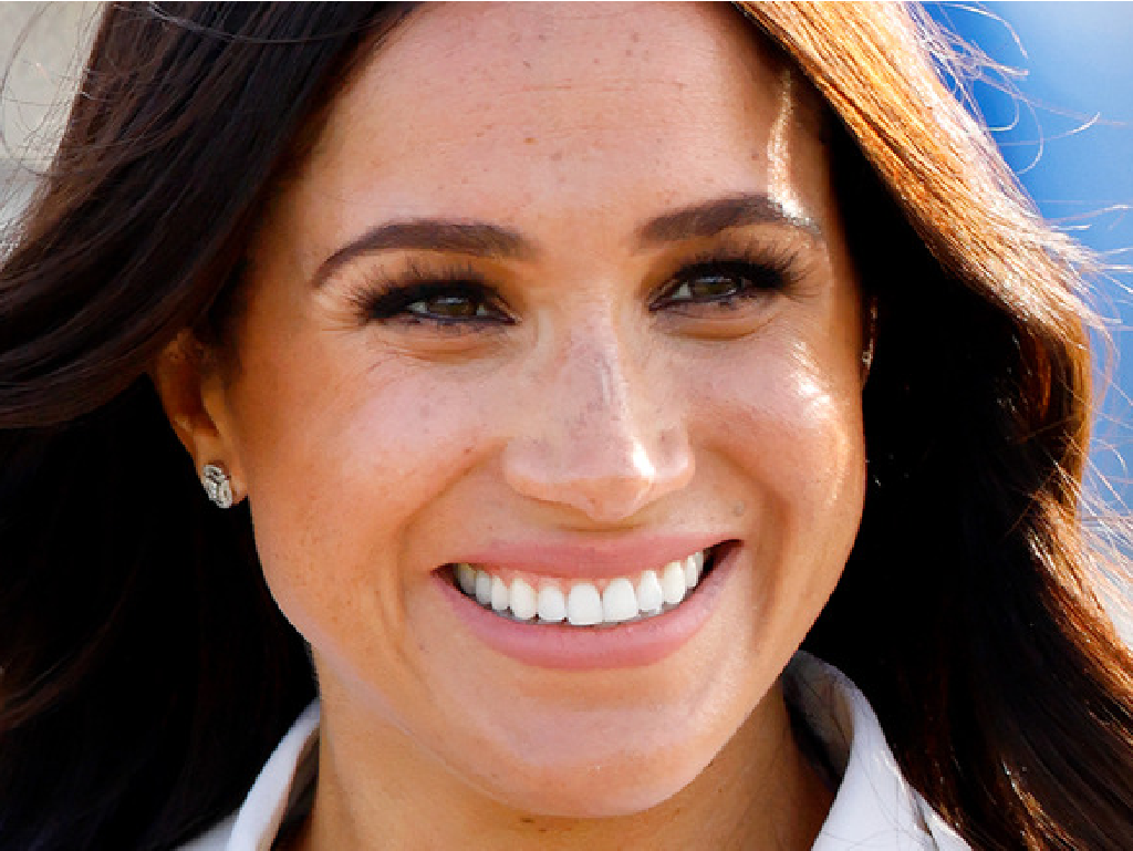 Welke beroemdheden hebben een tandheelkundige fineer?