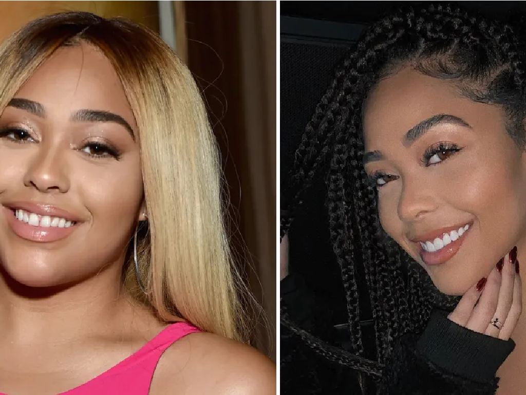 Welke beroemdheden hebben een tandheelkundige fineer?