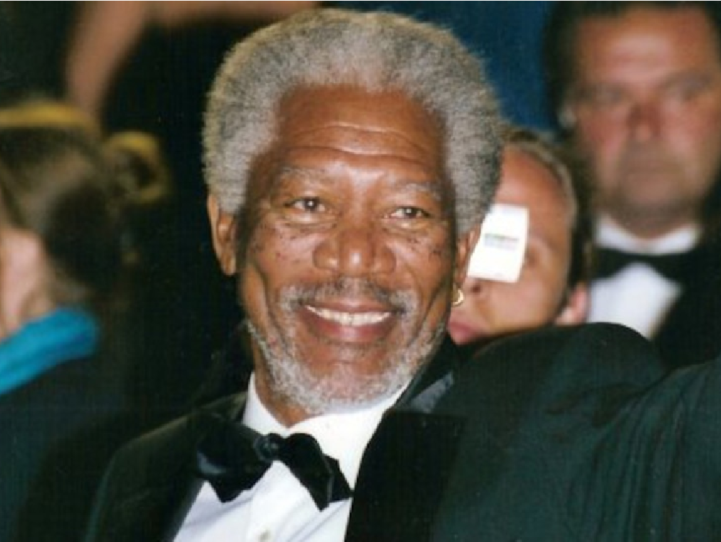 Welke beroemdheden hebben een tandheelkundige fineer?