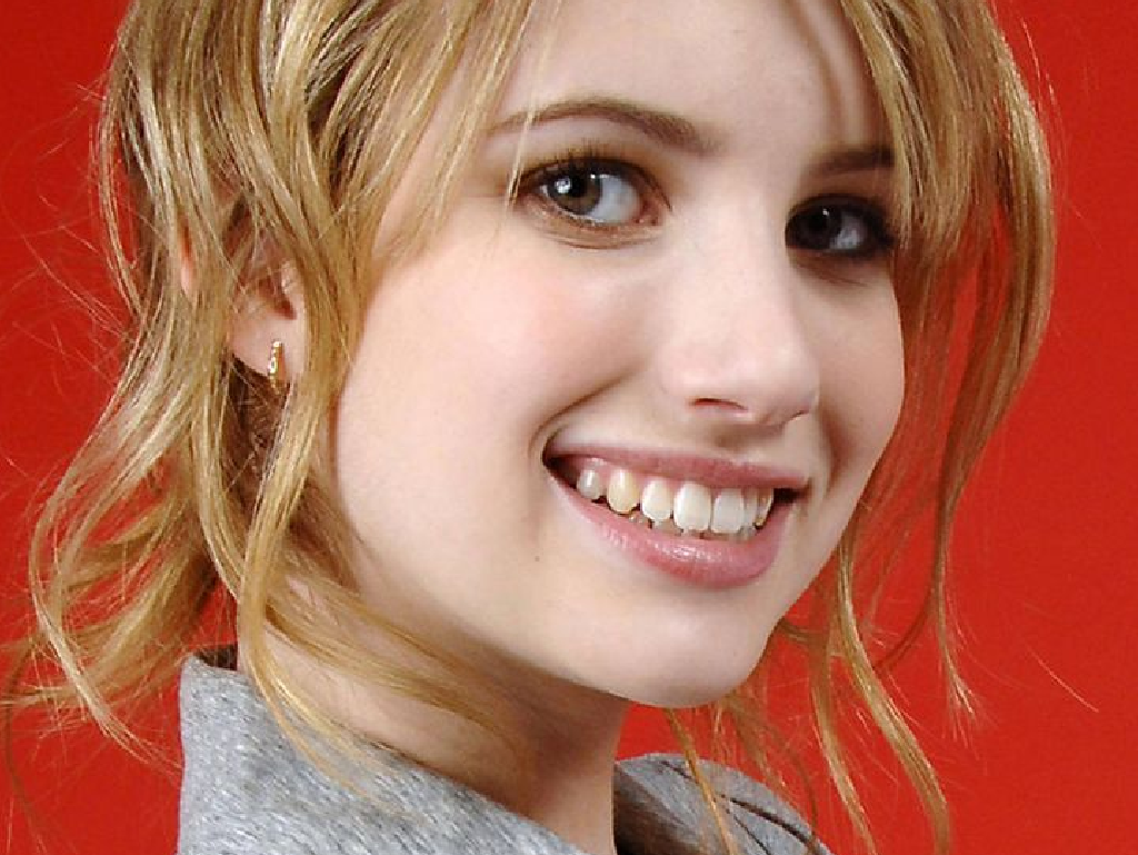 Welke beroemdheden hebben een tandheelkundige fineer?