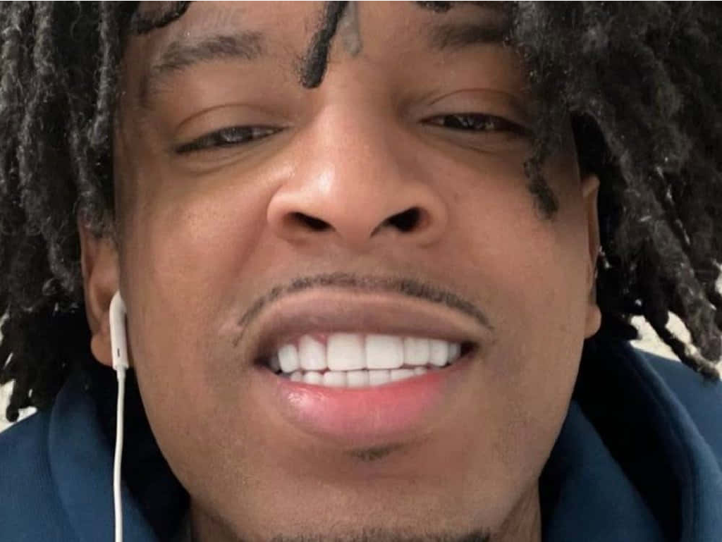 Welke beroemdheden hebben een tandheelkundige fineer?