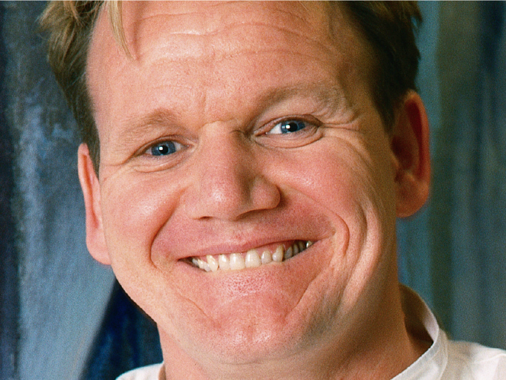 Welke beroemdheden hebben een tandheelkundige fineer?