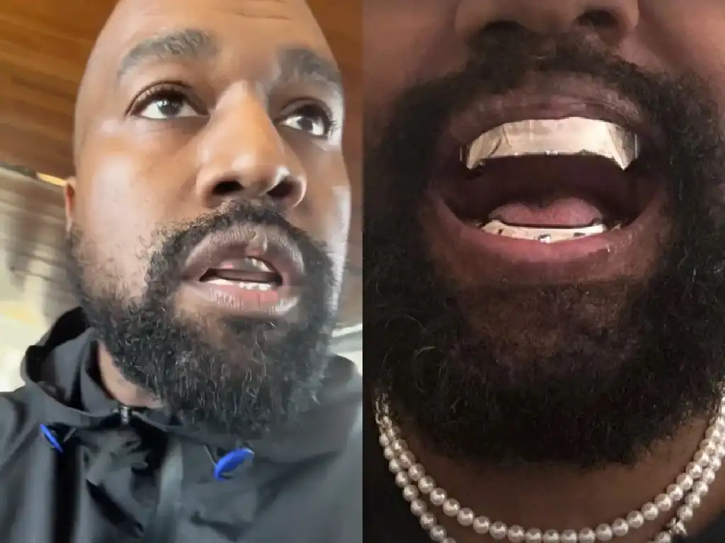 Kanye Wests titanium prothesetanden